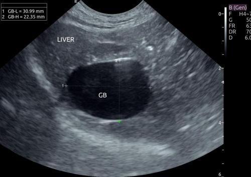 ultrasound 3